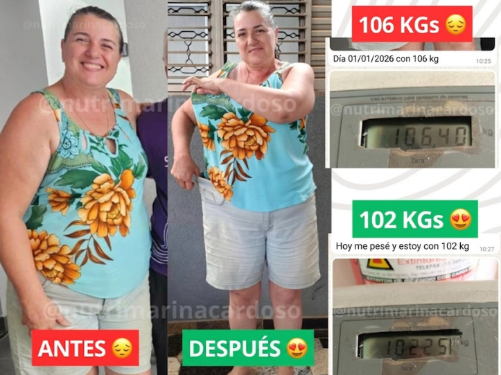 Antes y Después de Meire