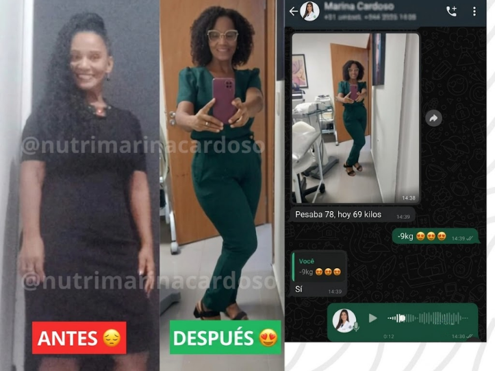 Antes y Después de Mirthes